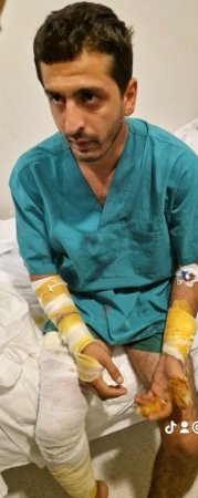 İcra başçısına etiraz edən Qarabağ Qazisi ÖZÜNƏ OD VURDU İcra başçısına etiraz edən Qarabağ Qazisi ÖZÜNƏ OD VURDU