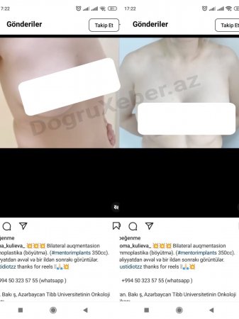 Qocaman deputat bu müəssisələrdən xəbərsizdirmi? Qocaman deputat bu müəssisələrdən xəbərsizdirmi?