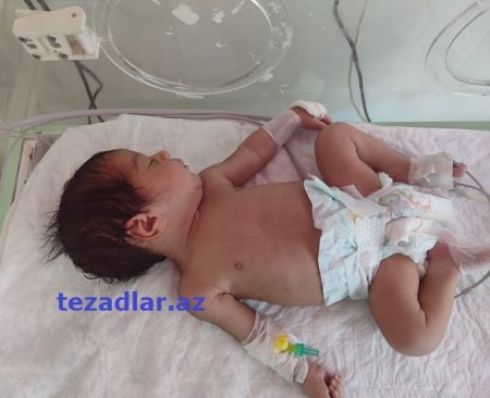 “Yeni Gəncə Tibb Mərkəzi”ndə KÖHNƏ OVQAT... “Yeni Gəncə Tibb Mərkəzi”ndə KÖHNƏ OVQAT...