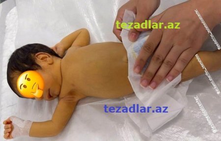 “Yeni Gəncə Tibb Mərkəzi”ndə KÖHNƏ OVQAT... “Yeni Gəncə Tibb Mərkəzi”ndə KÖHNƏ OVQAT...